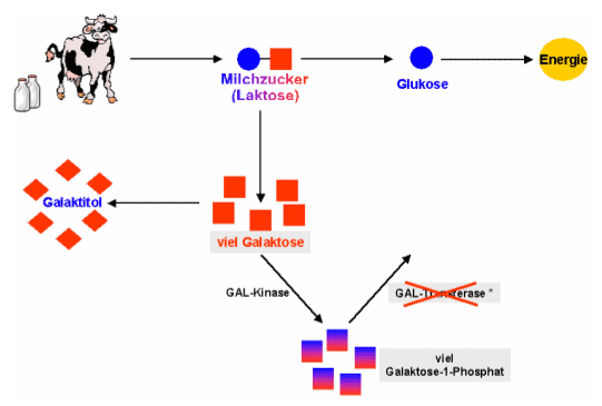 Galaktosestoffwechsel bei Patienten mit GALT-Mangel